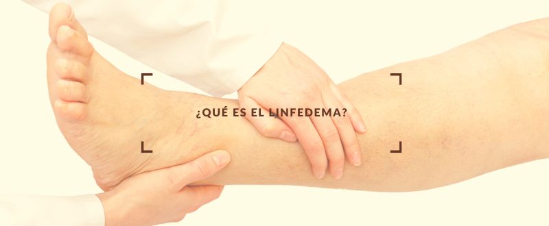 Enfoques Modernos Para El Linfedema Por Dianne Maxwel - vrogue.co